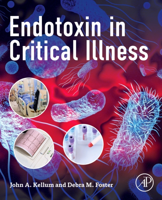 Endotoxin in Critical Illness