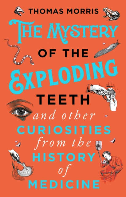 Mystery of the Exploding Teeth and Other Curiosities from the History of Medicine