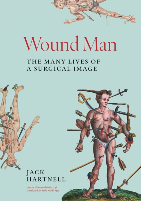 Wound Man