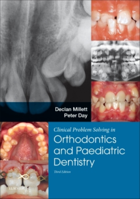 Clinical Problem Solving in Dentistry: Orthodontics and Paediatric Dentistry