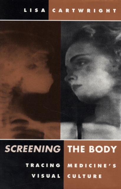 Screening The Body