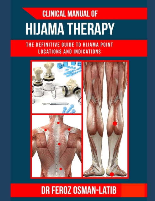Clinical Manual of Hijama Therapy