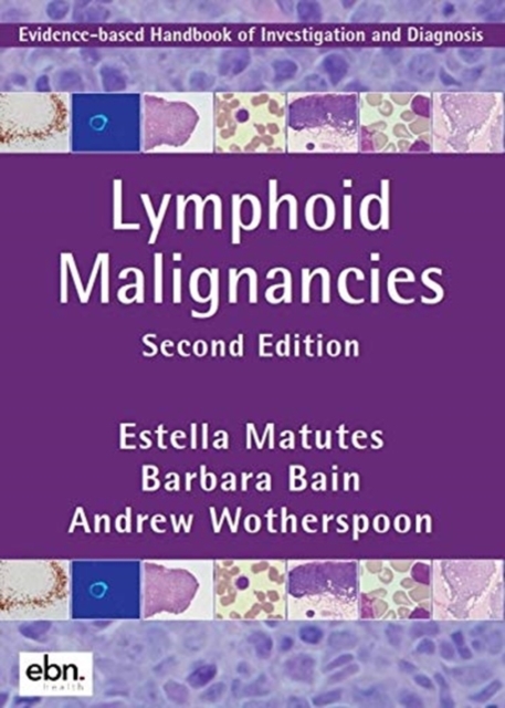 Lymphoid Malignancies