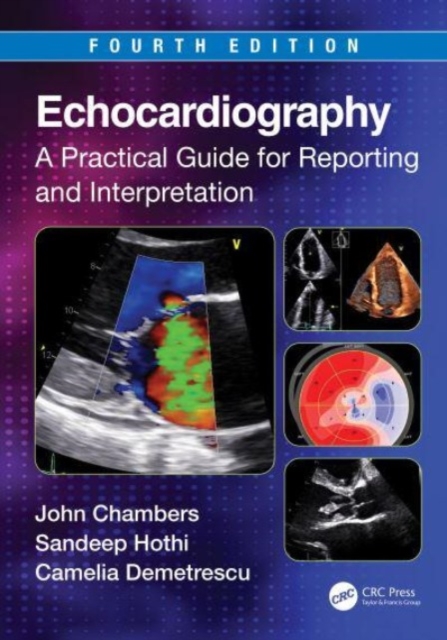 Echocardiography