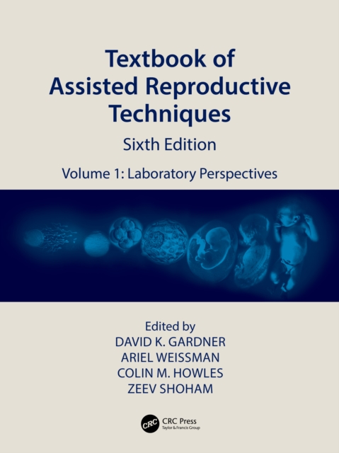 Textbook of Assisted Reproductive Techniques