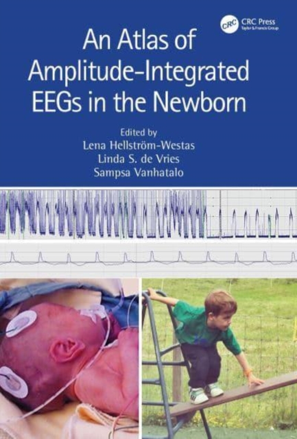 Atlas of Amplitude-Integrated EEGs in the Newborn