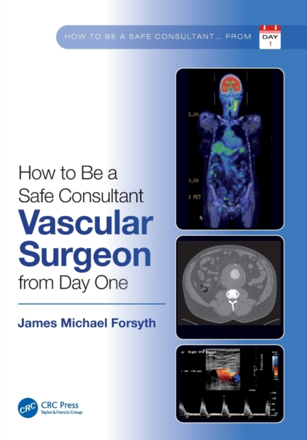 How to be a Safe Consultant Vascular Surgeon from Day One