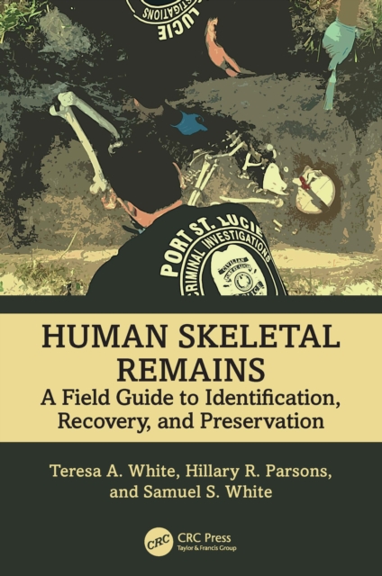 Human Skeletal Remains