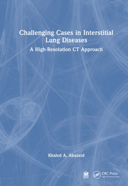 Challenging Cases in Interstitial Lung Diseases