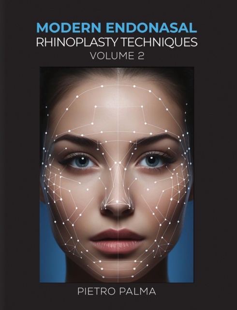 Modern Endonasal Rhinoplasty Techniques – Volume 2