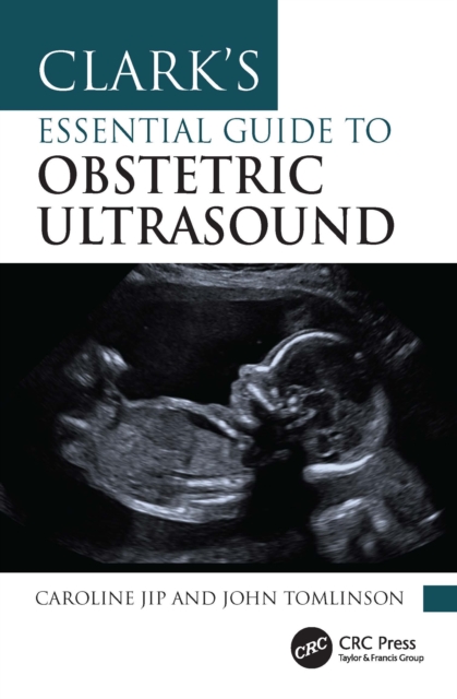 Clark's Essential Guide to Obstetric Ultrasound