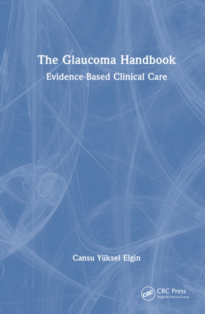 The Glaucoma Handbook