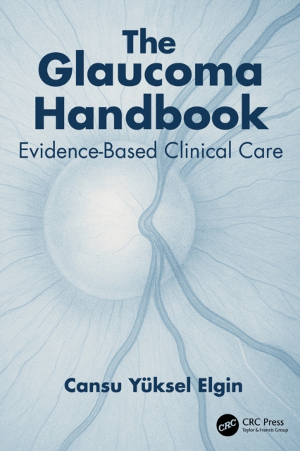 The Glaucoma Handbook