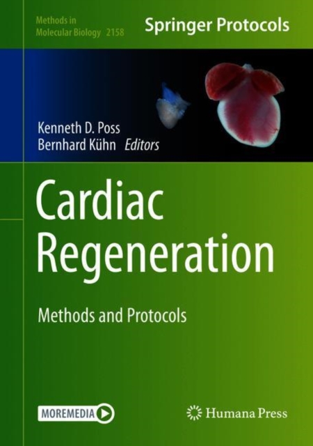 Cardiac Regeneration