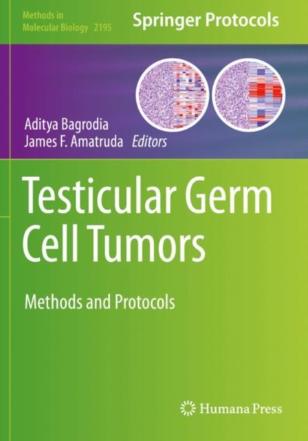 Testicular Germ Cell Tumors