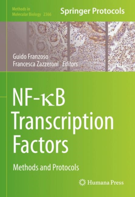 NF- B Transcription Factors