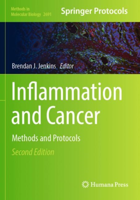 Inflammation and Cancer