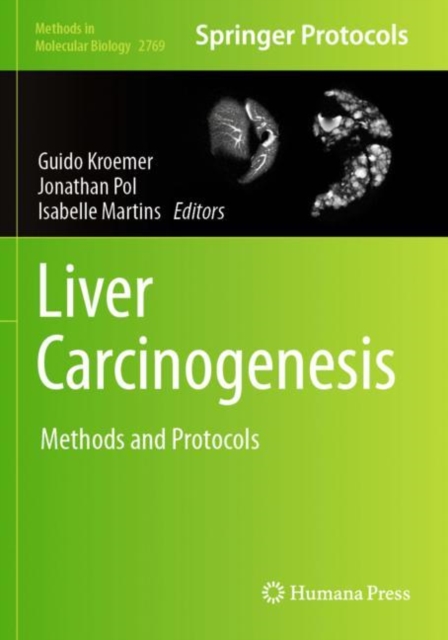 Liver Carcinogenesis