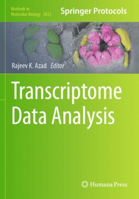 Transcriptome Data Analysis