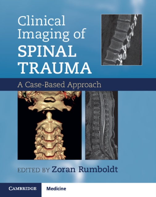 Clinical Imaging of Spinal Trauma