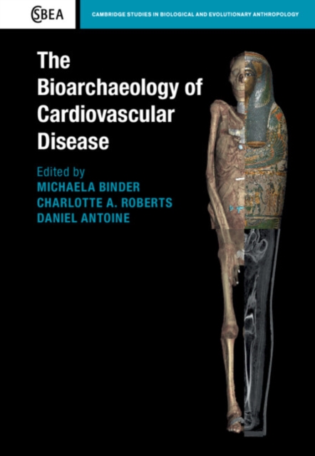 Bioarchaeology of Cardiovascular Disease