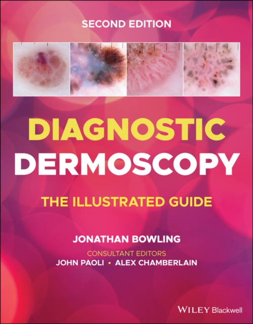 Diagnostic Dermoscopy - The Illustrated Guide, 2e