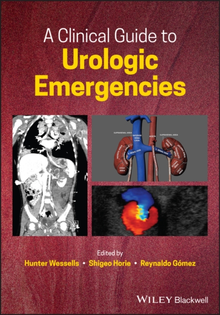 Clinical Guide to Urologic Emergencies