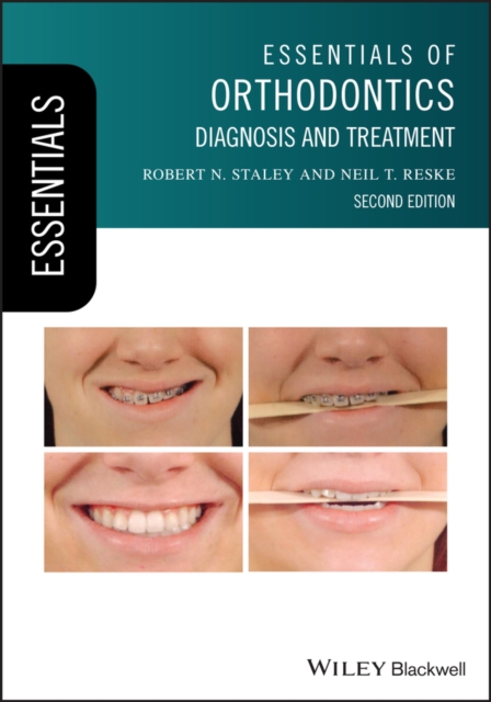 Essentials of Orthodontics: Diagnosis and Treatmen t, Second Edition