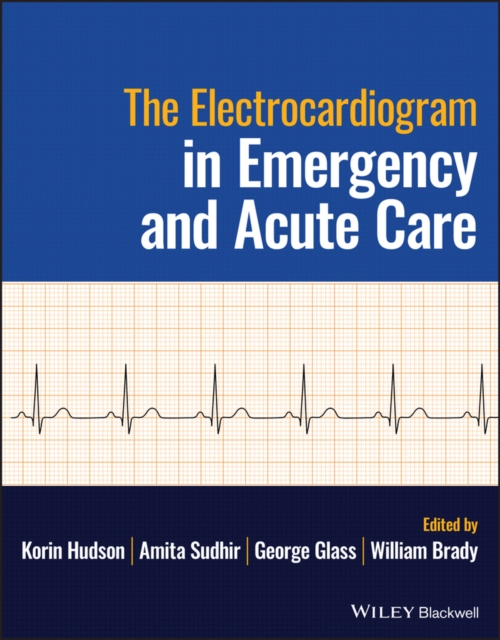 Electrocardiogram in Emergency and Acute Care