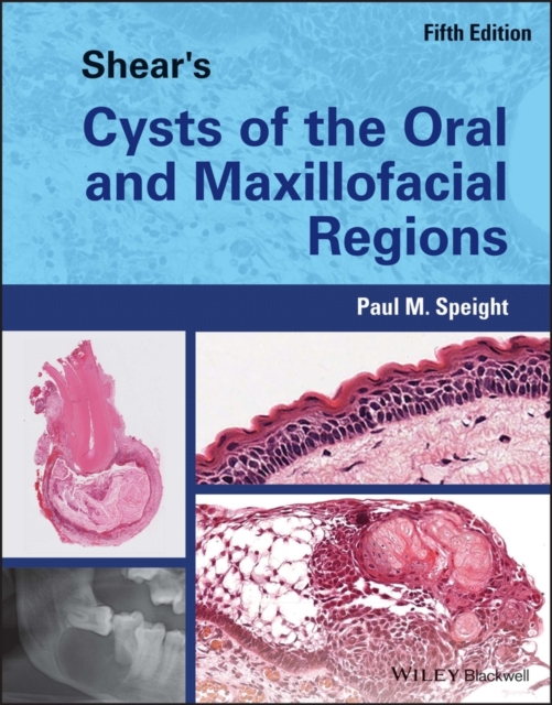 Shear's Cysts of the Oral and Maxillofacial Region s 5th Edition