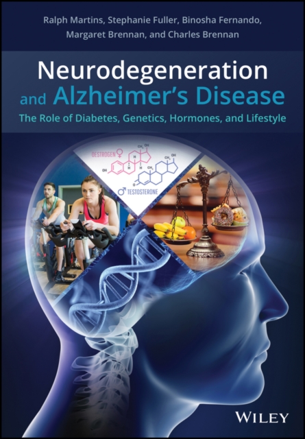 Neurodegeneration and Alzheimer's disease - The Role of Diabetes, Genetics, Hormones, and  Lifestyle