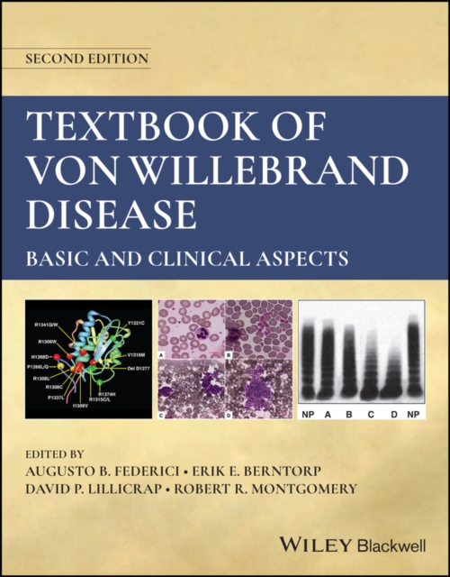 Textbook of Von Willebrand Disease