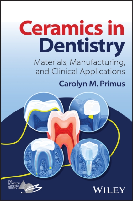 Ceramics in Dentistry