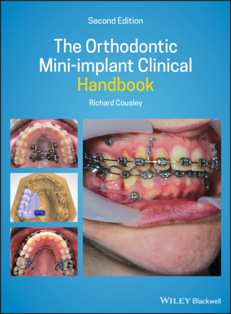 Orthodontic Mini-implant Clinical Handbook