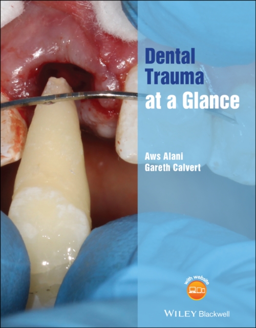 Dental Trauma at a Glance