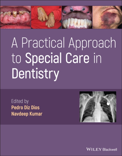 Practical Approach to Special Care in Dentistry