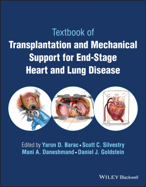Transplantation and Mechanical Support for End-Sta ge Heart and Lung Disease, 2 volume set