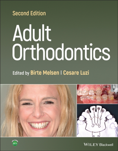 Adult Orthodontics 2nd Edition