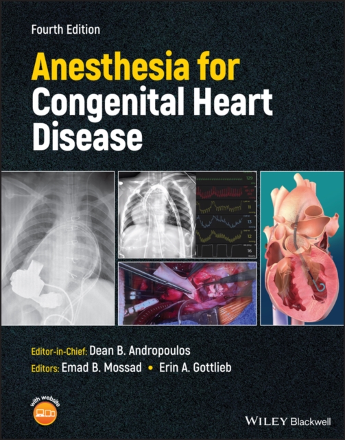 Anesthesia for Congenital Heart Disease 4e