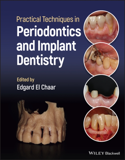 Practical Techniques in Periodontics and Implant D entistry