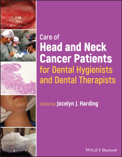 Care of Head and Neck Cancer Patients for Dental H ygienists and Dental Therapists