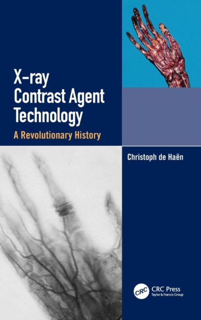 X-ray Contrast Agent Technology