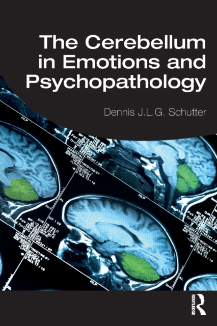 The Cerebellum in Emotions and Psychopathology