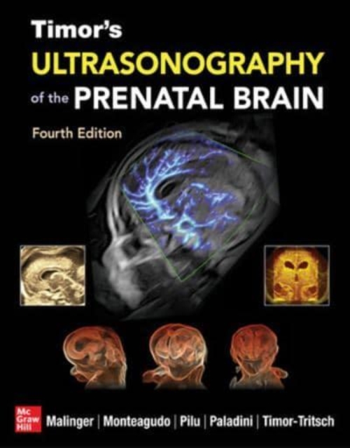 Timor's Ultrasonography of the Prenatal Brain, Fourth Edition