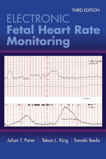 Electronic Fetal Heart Rate Monitoring: the 5-Tier System