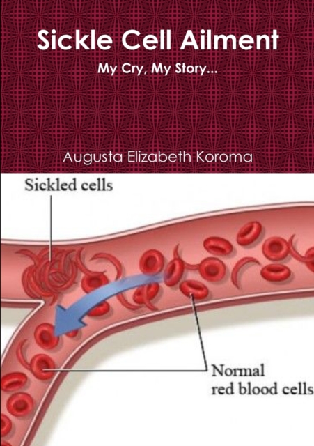 Sickle Cell