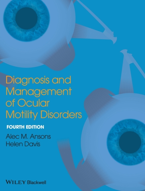Diagnosis and Management of Ocular Motility Disorders 4e