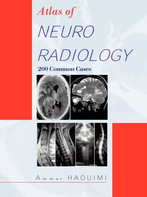 Atlas Of NEURORADIOLOGY