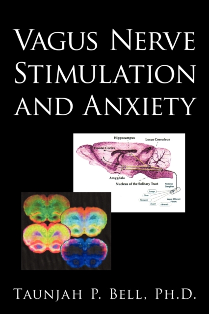 Vagus Nerve Stimulation and Anxiety