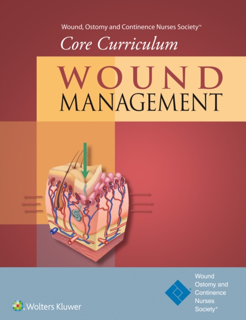 Wound, Ostomy and Continence Nurses Society (R) Core Curriculum: Wound Management